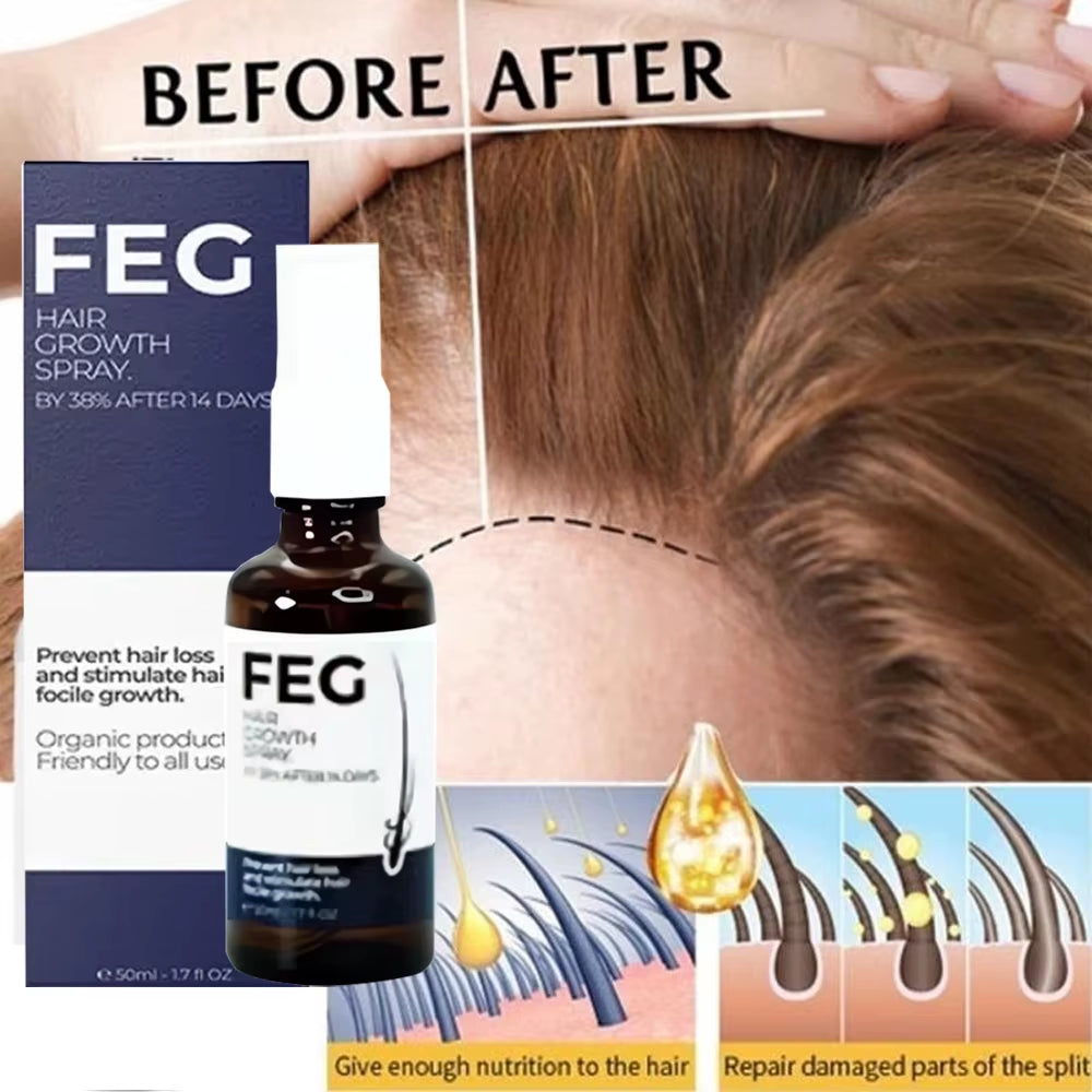 Best Hair Care Product FEG Hair Care Spray Serum for Hair Loss 50Ml